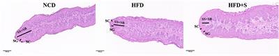 Dietary spirulina supplementation modifies rumen development, fermentation and bacteria composition in Hu sheep when consuming high-fat dietary